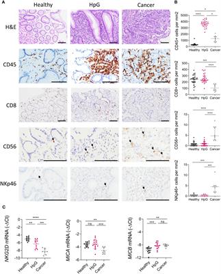 Immune evasion by proteolytic shedding of natural killer group 2, member D ligands in Helicobacter pylori infection